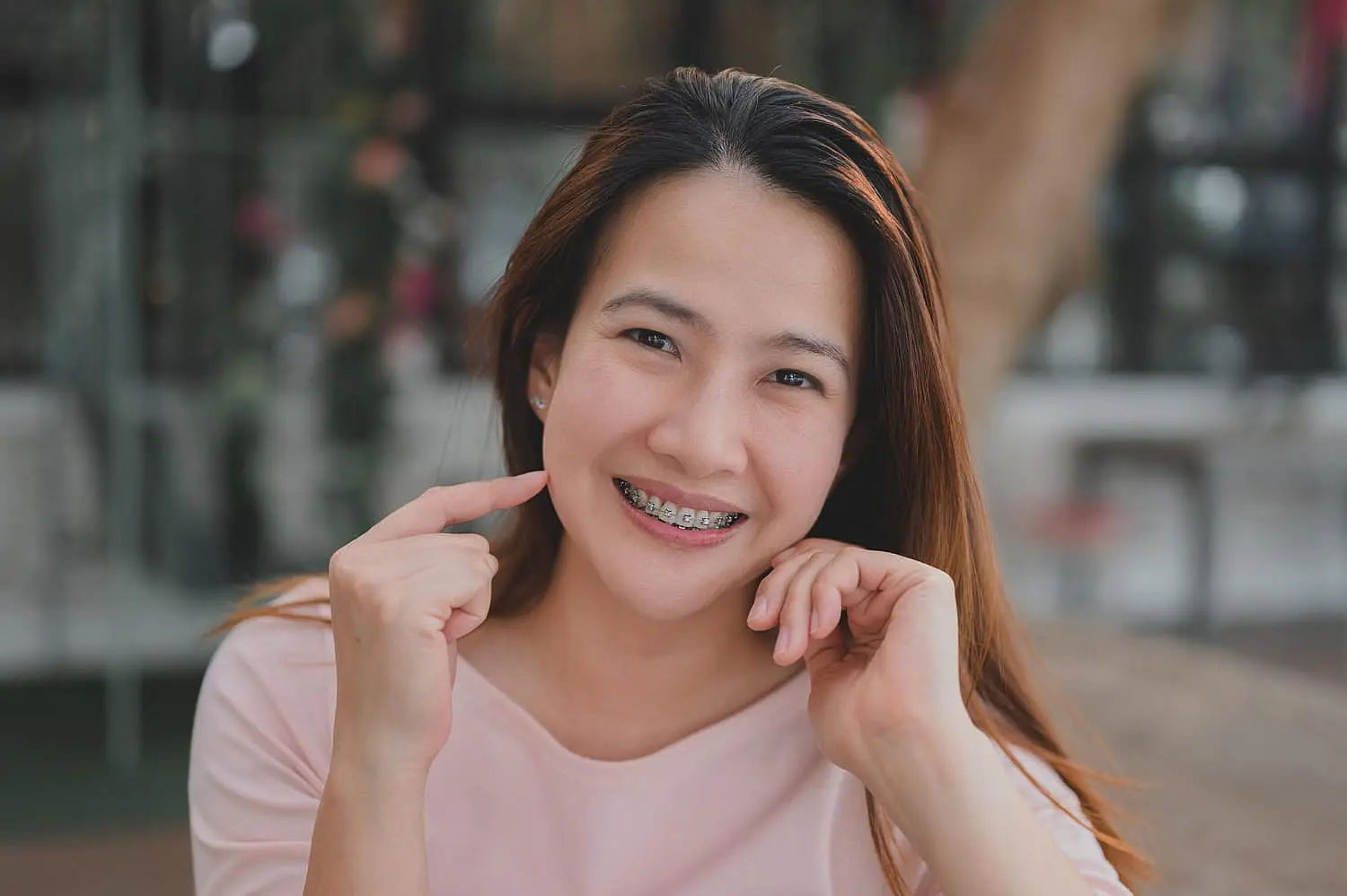 A woman with long hair and braces showcases the joy of adult orthodontics as she smiles at the camera, pointing to her cheeks. Her pink top complements the vibrant energy in an indoor setting with a softly blurred background in Leominster and Gardner, MA