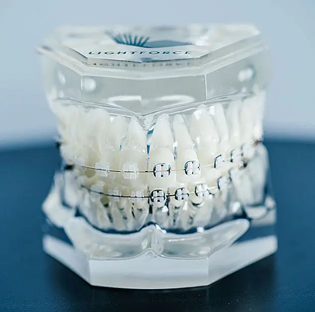 A clear dental model showcases a full set of upper and lower teeth with LightForce braces, elegantly enclosed in a hexagonal stand in Leominster or Gardner, MA