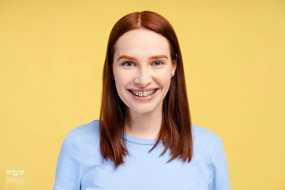 a woman smiling at the camera after understanding about how long do braces take in leominster and gardner, ma