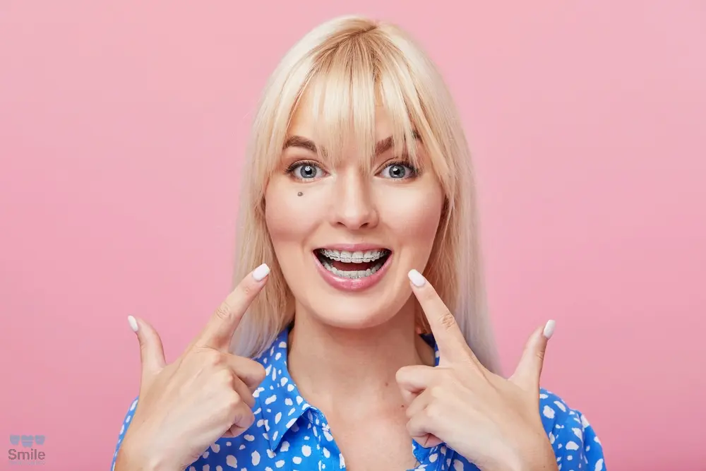 cheerful happy young woman blonde hair gesturing thumb while pointing clear braces - Clear Braces vs Metal Braces in Leominster and Gardner, MA