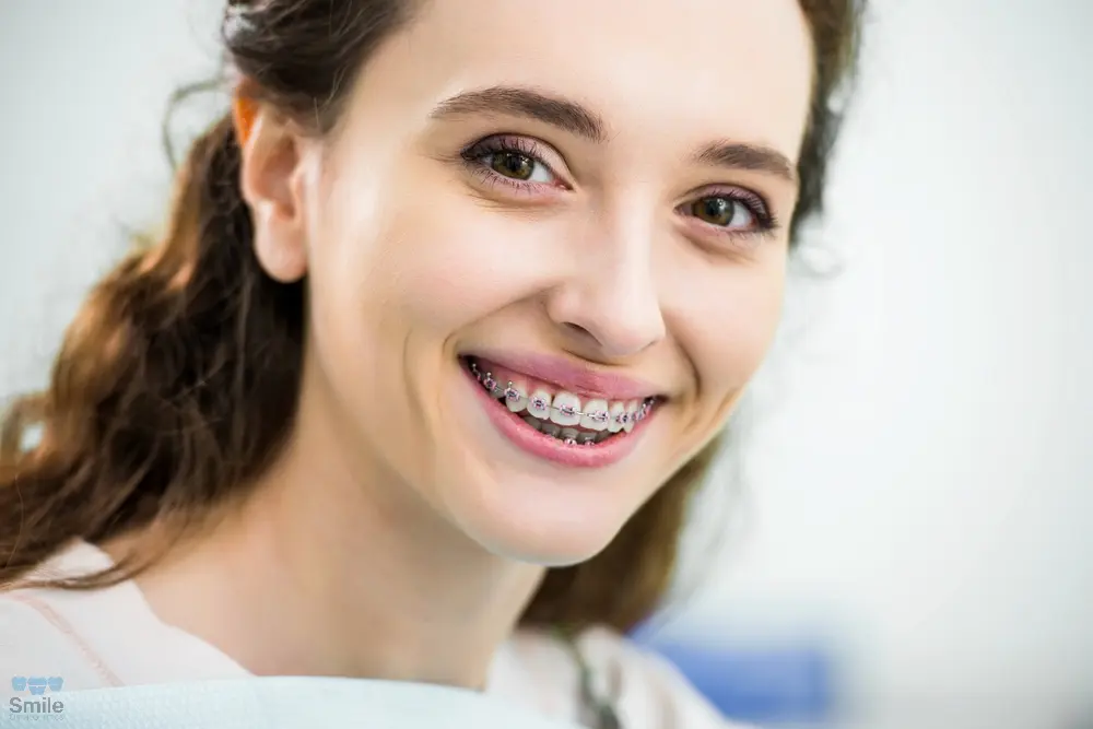 close happy woman metal braces teeth smiling dental clinic - How to Clean Braces in Leominster, MA 