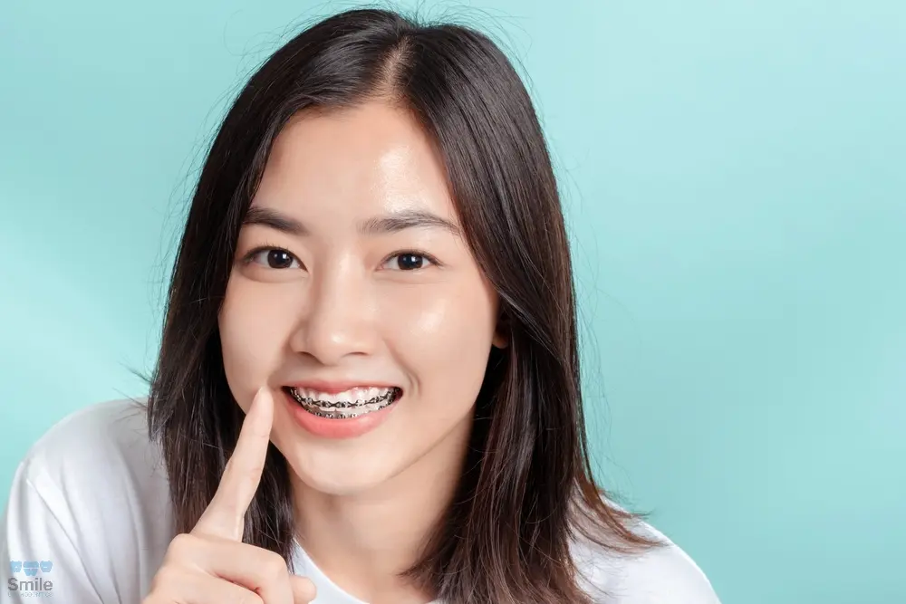 dental braces young asian woman wearing metal braces beauty smile - How to Clean Braces in Leominster, MA 